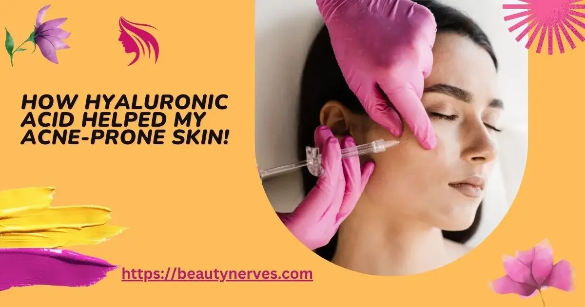 Is Hyaluronic Acid Good For Acne